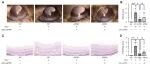 首都医科大学侯胜平/雷峰阳合作最新Science子刊