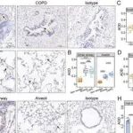 Adv  Sci | 南京医科大学姚欣等团队合作发现促进肺气肿发生的调控新机制