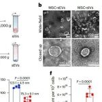 Nat Biomed Eng | 囊泡治疗新选择，天津医科大学张晓敏/李筱荣合作证实小型细胞内囊泡在递送效率与神经保护方面全面超越外泌体