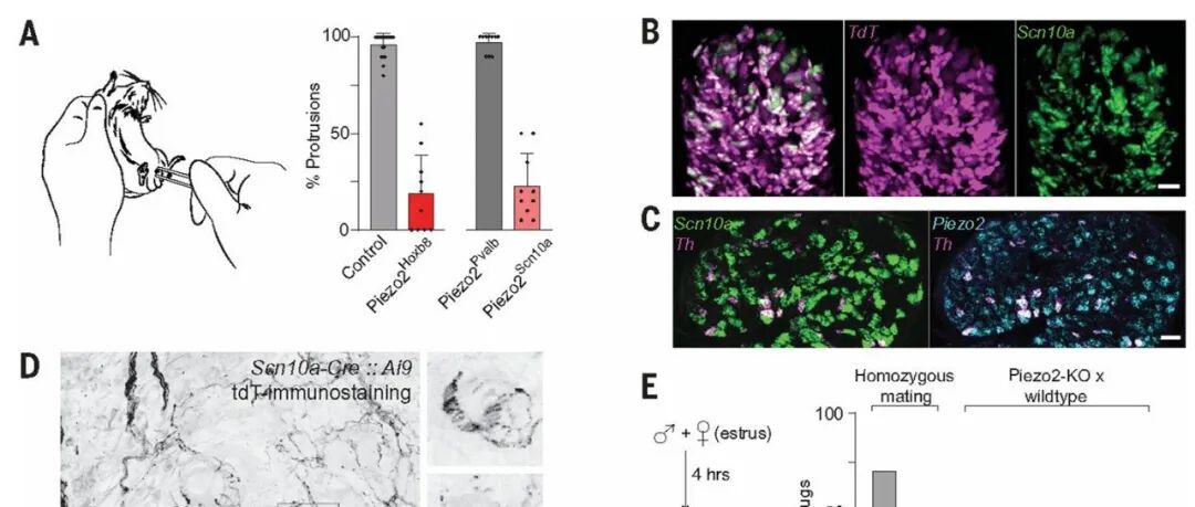 Science | 科学家发现轻柔触摸激发性快感的关键开关