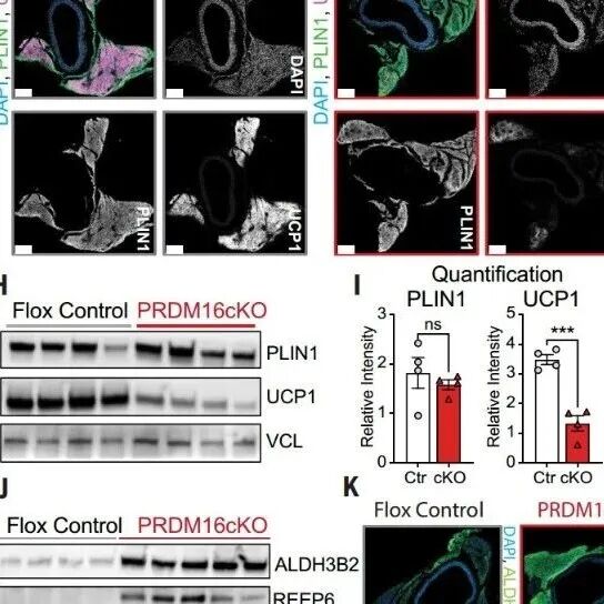 Science｜身体里的“好脂肪”叛变了？当它失去产热特性，就会从血管守护者变成破坏者