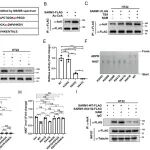 PNAS | 复旦大学余巍团队发现加重糖尿病周围神经病变的调控新机制