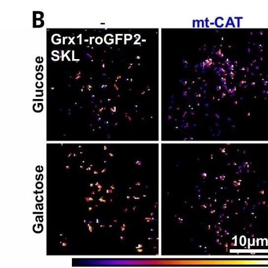 Science | 线粒体压力大？邻居过氧化物酶体通过直接接触来帮忙“灭火”