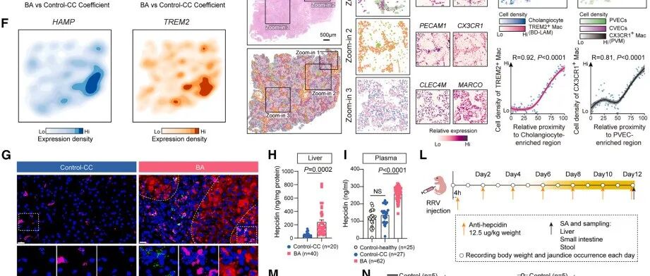 Immunity | 铁代谢紊乱损害新生儿病毒免疫能力并介导轮状病毒相关肝损伤