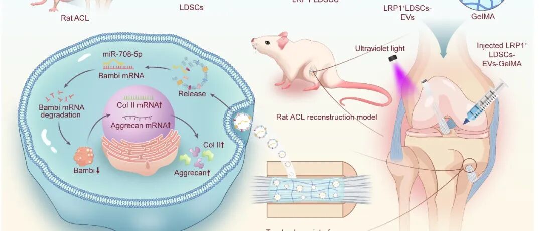 Biomaterials｜中南大学湘雅医院吕红斌/张涛/李成军团队：LRP1\u207A韧带干细胞分泌的细胞外囊泡促进前交叉韧带重建后肌腱-骨愈合