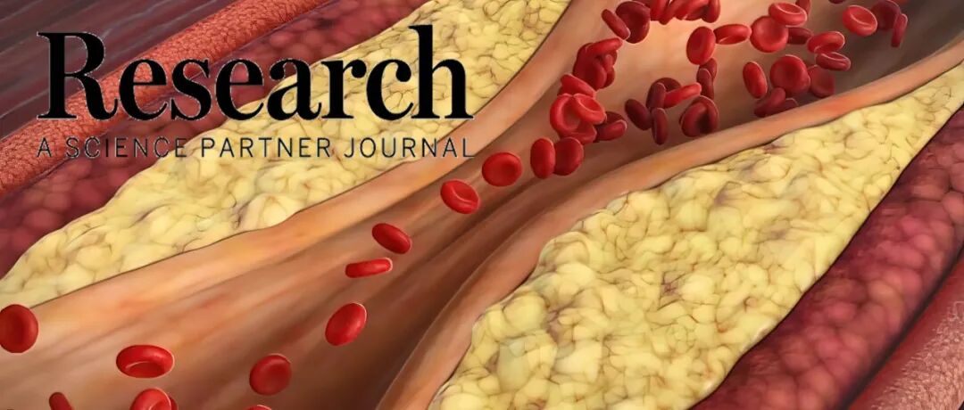 Research|南方医科大学杨志禄研究员和王颖副研究员提出可灌注微流控血管芯片用于动脉粥样硬化药物