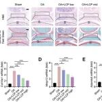 Autophagy | 汕头大学等研究团队发现减轻骨关节炎的进展的潜在新策略