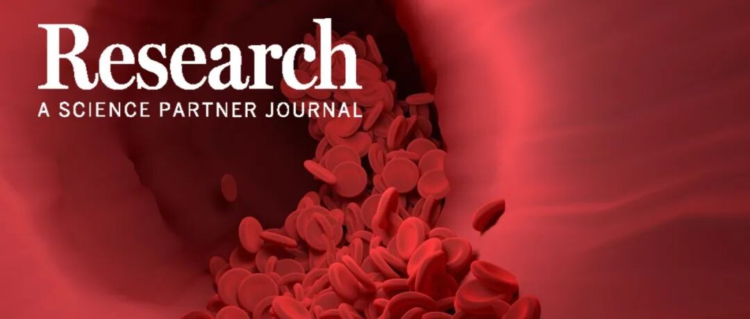 Research|上海交通大学医学院附属第九人民医院陆琳娜团队揭示“组蛋白-RNA”修饰串扰促进眼底新生血管调控机制