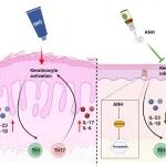 Commun Biol｜郑州大学附属郑州中心医院夏正远/储勤军：负载脱水淫羊藿素的间充质干细胞来源外泌体通过ACSL4介导的铁死亡改善小鼠银屑病