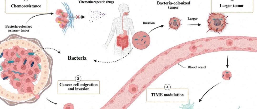 ACS Appl. Mater. Interfaces. | 靶向肿瘤内菌群：纳米技术开启抗癌新方向