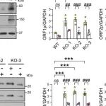 Nat Aging | 对抗心脏老化，宋默识团队发现抑制LINE-1可延缓心脏衰老