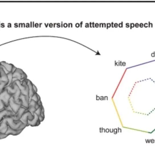 Cell | “读心术”来了！脑接机口实时解读“内心独白”，自带密码保护，防止隐私泄漏