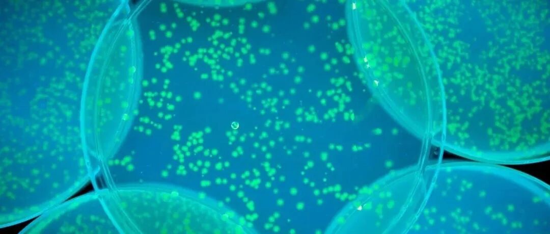 Adv Sci | 黄俊祺/Chew Ting Gang/庞丽娟/郭允苗：ERM-肌动蛋白轴通过ROS-NRF2调控铁死亡