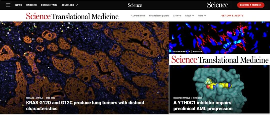 【Science子刊】四川大学杨胜勇等开发首个靶向YTHDC1的高选择性小分子抑制剂，展现卓越抗急性髓系白血病活性