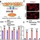 Adv Sci | 山东大学卢矫阳等团队发现缓解肠纤维化的潜在新策略