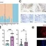 Adv Sci | 中南大学陈翔等团队通过单细胞RNA测序解析人阴茎鳞状细胞癌的细胞异质性与恶性进展