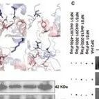 Adv Sci | 上海交通大学薛松等团队发现减轻腹主动脉瘤的潜在新策略