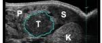 【美图欣赏】小鼠胰腺肿瘤三维成像