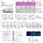 Adv Sci | 丁秋蓉等团队解码硒的保肝密码：发现硒蛋白H-PPARα轴调控脂肪酸氧化，防治代谢性脂肪肝