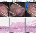 Adv Sci | 南方医科大学李庆等团队发现对抗湿疹的“肠道援军”：新型益生菌从肠道“派兵”，平息皮肤免疫风暴