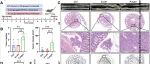Cancer Res | 南京医科大学封益飞等团队锁定肿瘤“内鬼”菌：普雷沃菌既是肠癌预警标志，又是药物靶点，补充其偷走的营养可逆转免疫抑制