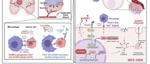 Cell Death & Disease｜山东大学齐鲁医院李刚/薛皓团队发文揭示低氧外泌体IGFBP2调控CD47的表达促进胶质母细胞瘤免疫逃逸新机制