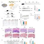 Phytotherapy Research\u00A0｜ 重庆理工大学/重庆大学附属重庆市人民医院 ：大蒜外泌体通过调控PFKFB3介导的代谢重编程缓解克罗恩病肠纤维化