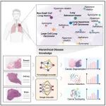 Cancer Cell | 上海交通大学谢伟迪团队开发的KEEP病理基础模型通过知识图谱,零样本诊断30种罕见脑癌