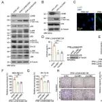 Cancer Res | 武汉大学李文化团队发现抗转移新思路：重启肿瘤微环境中的“代谢刹车”