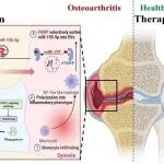 Bone Res | 拦截关节“炎症快递”！同济大学徐俊等团队揭示骨关节炎软骨破坏新通路，并开发“拆弹”疗法