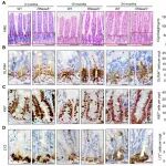 Cancer Res | 促癌因子实为早期抑癌关键！浙江大学许正平等发现RNase5可预防肠癌，水平高低与患病风险负相关