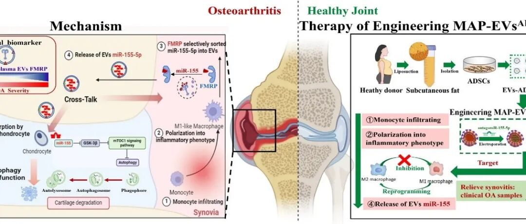 Bone Res｜同济大学医学院徐俊教授团队破解骨关节炎早期阶段慢性炎性启动软骨退变的难题，创建基于工程化外泌体的骨关节炎诊疗新策略