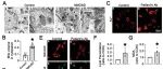 Cell Death & Differ | 锁定星形胶质细胞铁死亡！华南理工大学旺鸿浩等团队揭示ACSL4是驱动NMOSD进展的关键因子，提出治疗新靶点