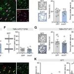 Neuron | 压力大坐立不安？浙江中医药大学陈忠/汪仪揭示星形胶质细胞H3受体调控焦虑神经机制