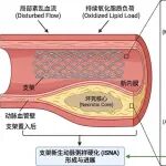【2026面上精修版】CYBB/NOX2介导巨噬细胞胞葬障碍驱动支架新生动脉粥样硬化的机制及靶向干预研究