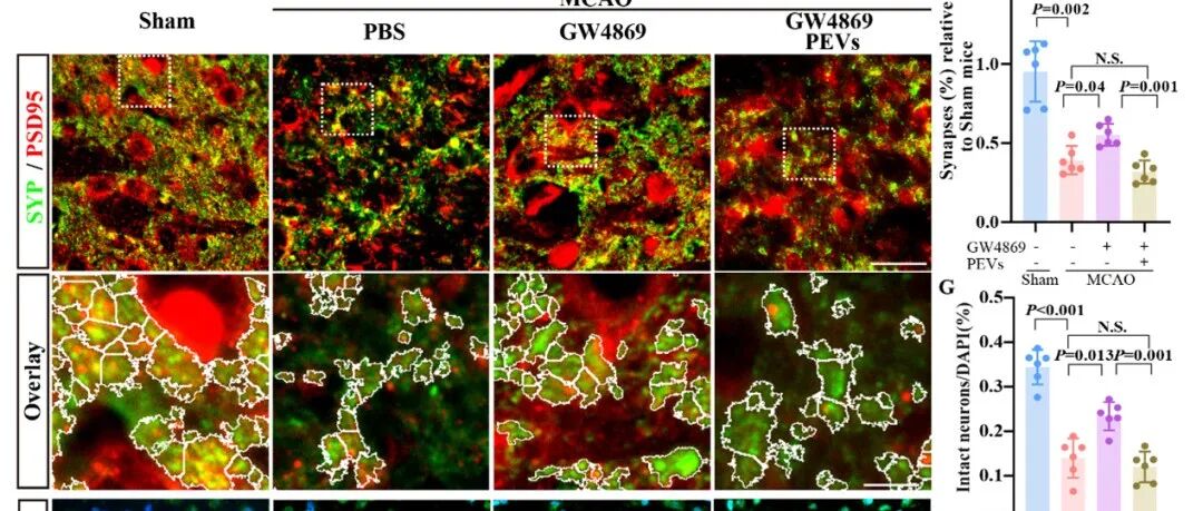 Brain\u00A0|\u00A0逯丹/徐安定/麦鸿成研究成果揭示缺血半暗带细胞外囊泡远程递送致病RNAs新机制