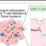 Cell子刊 | 朱墨桃/杨尹默巧用异源自噬，瘤内益生菌新抗原唤醒CD4 T细胞狙击胰腺癌