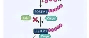 Adv Sci | 山东大学杨其峰团队发现TRIM38通过调节SQSTM1泛素化和自噬流来抑制乳腺癌进展