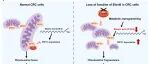 Sci Adv | 南京大学华子春等团队提出结直肠癌防治新策略：靶向激活Elovl6或膳食补充硬脂酸，通过代谢重编程抑制肿瘤