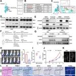 Adv Sci | 解放军总医院许猛等团队为骨肉瘤带来“即用型”希望：抗寄生虫药伊维菌素被证实可阻断关键致癌通路，抑制肿瘤
