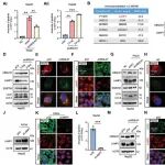 Autophagy | 脂肪肝如何走向肝纤维化？江苏大学严永敏团队发现肝细胞释放的“致病囊泡”是关键信使，携带UBQLN1蛋白激活成纤维细胞