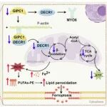 Cell Death & Differ | 扩张型心肌病如何走向心衰？哈尔滨医科大学杨宝峰等团队发现心脏支架蛋白GIPC1缺失，引发致命铁死亡