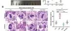 Adv Sci | 华中科技大学谢大兴等团队发现YAP蛋白的相分离作用促进乳腺癌细胞的异常有丝分裂
