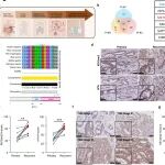 Cancer Res | 帮肿瘤“隐身”的蛋白开关！华中科技大学罗学来/李海杰发现METTL3特定修饰可关闭免疫警报，纠正它或可提升免疫疗法效果