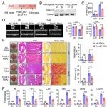 PNAS | 苏州大学李敏/徐薇等合作发现新型心肌炎治疗靶点