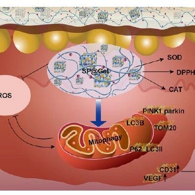 ACS Nano：仿生硒包裹的普鲁士蓝纳米酶可通过增强线粒体自噬和活性氧物质清除治疗心肌梗死
