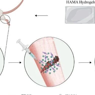 北京大学第三医院王健全教授团队《Materials Today Bio》：可注射复合微球水凝胶膜，助力跟腱损伤再生与抗粘连