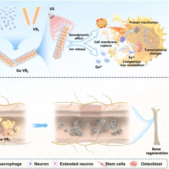 Biomaterials | 南方医科大学钟华等团队利用声动力与离子干扰协同疗法高效治疗骨髓炎并促进神经与成骨再生