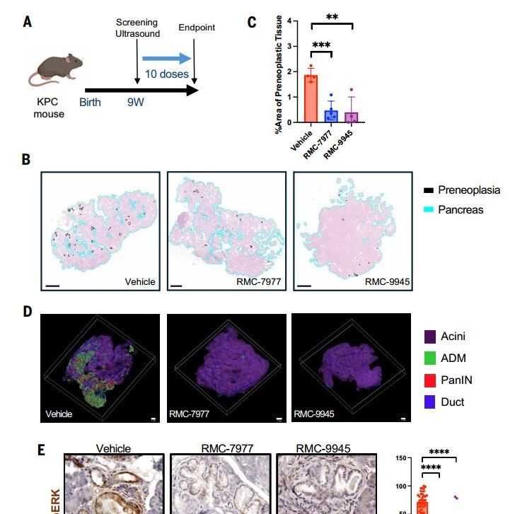 Science | 抢在癌症形成之前，KRAS抑制剂在胰腺癌临床前模型中实现"癌症拦截"