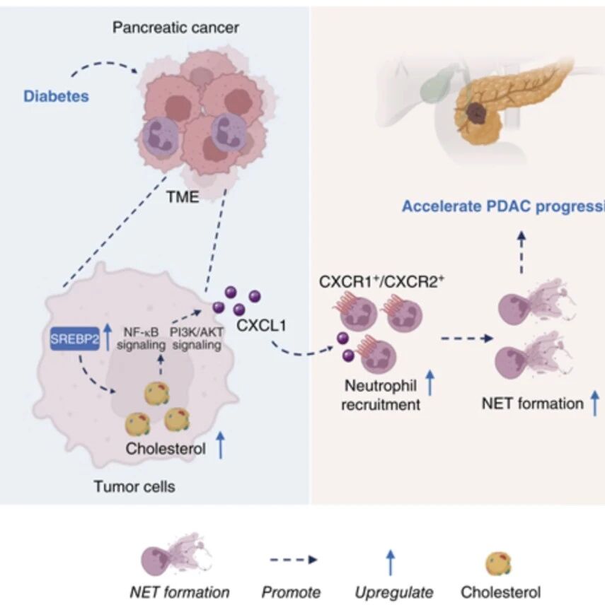 Cancer Res | 代谢紊乱如何“助攻”癌王？哈尔滨医科大学孙备/李乐发现糖尿病为胰腺癌“铺设”免疫陷阱，阻断它可三管齐下